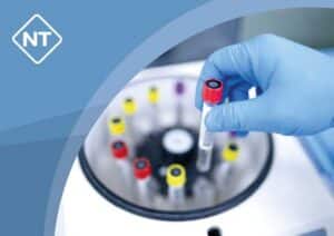 Proben im Labor, Beitragsbild PFAS-Analyse